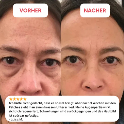 VELOURA MIKRO-NADEL PADS + GRATIS E-BOOK